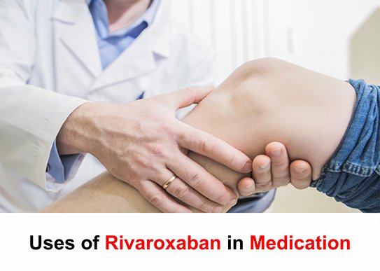 Rivaroxaban